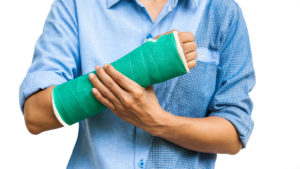 Green cast on an arm of a women isolated on white background